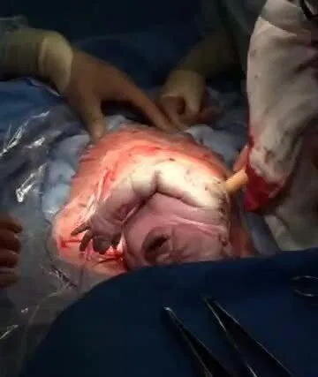 Uşaq anasının bətnindən çıxan kimi yatdı - Doğum evində maraqlı görüntülər - FOTOLAR