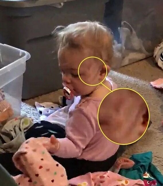 Üzündə cızıqlar yaranan körpənin otağına kamera qoydular - ŞOK EDƏN GÖRÜNTÜ - VİDEO