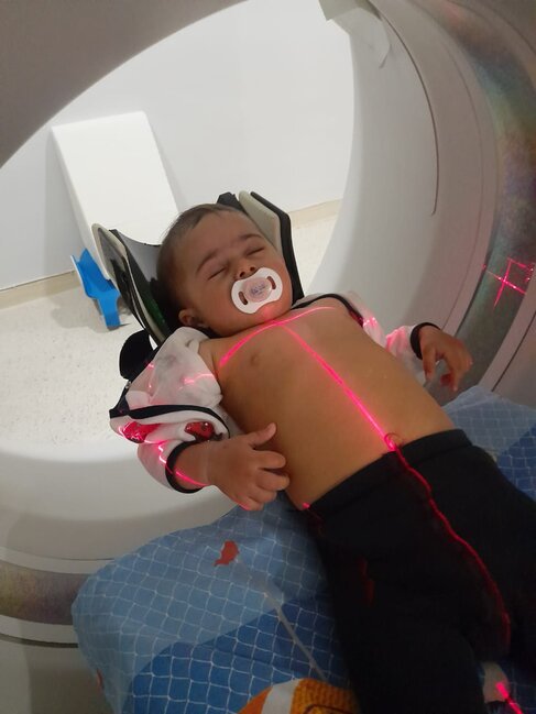 7 dəfə əməliyyat olunan balaca Rənanın dəstəyə ehtiyacı var - FOTO