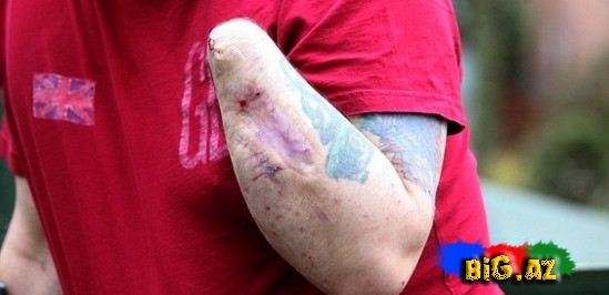 Həkimlərdən bezib əlini kəsdi - DƏHŞƏT-VİDEO