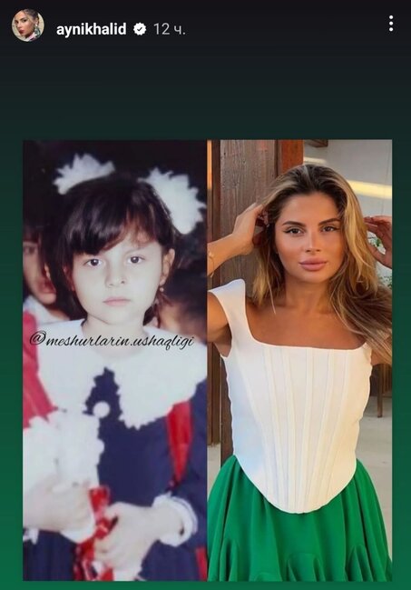 Aynişan uşaqlıq FOTOsunu paylaşdı