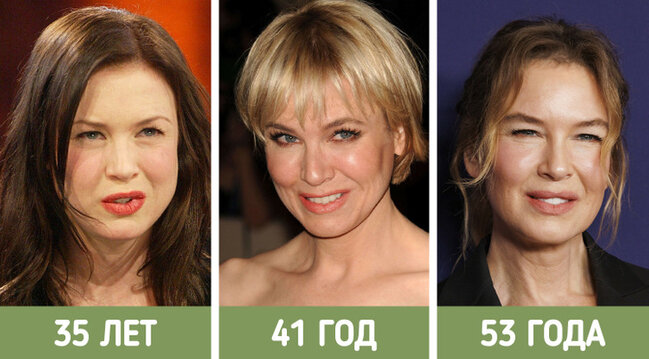 İllər ərzində sanki fərqli insanlara çevrilən ULDUZLAR - FOTO