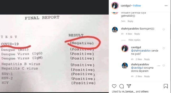 Azərbaycanlı məşhurlar koronavirusa görə test etdilər, cavab isə... - FOTO