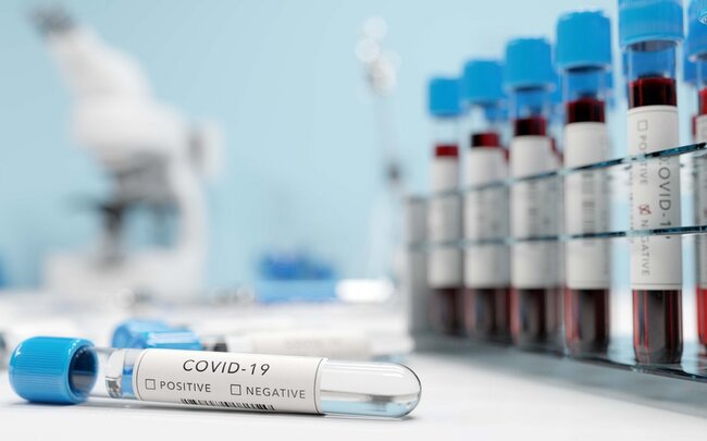 Daha 34 şagird və 21 işçidə koronavirus aşkarlanıb