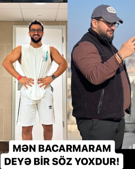 Abbas heç vaxt göstərmədiyi halını nümayiş etdirdi - Foto