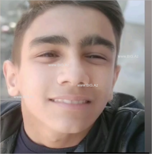 Faciəvi şəkildə ölən 12 yaşlı Rəvanın FOTOLARI
