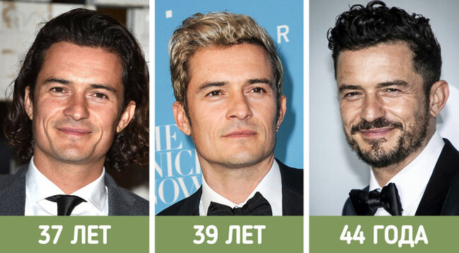 İllər ərzində sanki fərqli insanlara çevrilən ULDUZLAR - FOTO