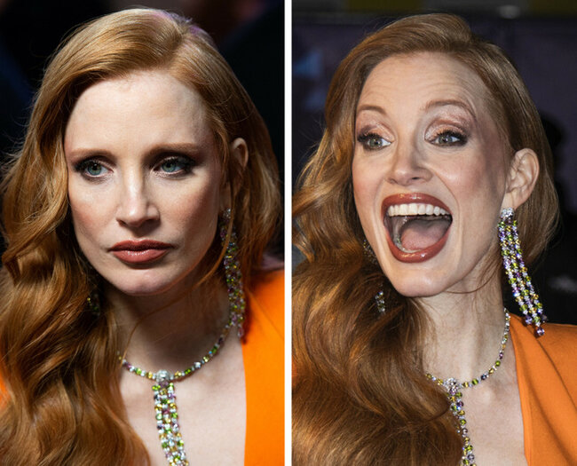 Təbəssüm etdikdə sanki başqa insana çevrilən 17 ULDUZ - FOTO