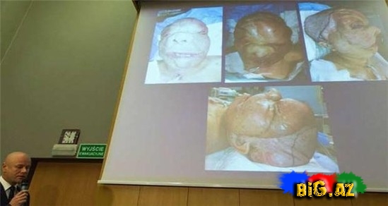 26 yaşlı qız yeni sifətə sahib oldu - FOTO