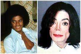 Dünyaca məşhur ulduzların uğursuz plastik əməliyyatları - FOTO