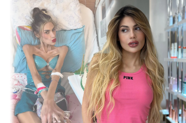 23 kiloqram olan Nihal Candanın orqanları fəaliyyətini dayandırıb