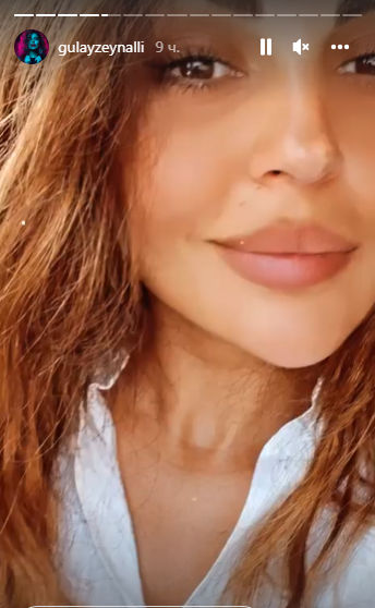 Gülay Zeynallı gözəlliyi ilə HEYRAN ETDİ - FOTO