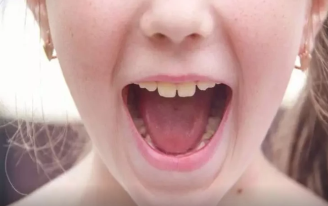 Süd dişləri niyə belə adlanır?