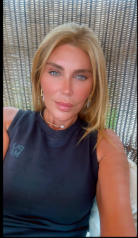 Xoşqədəm TANINMAZ HALDA - FOTO