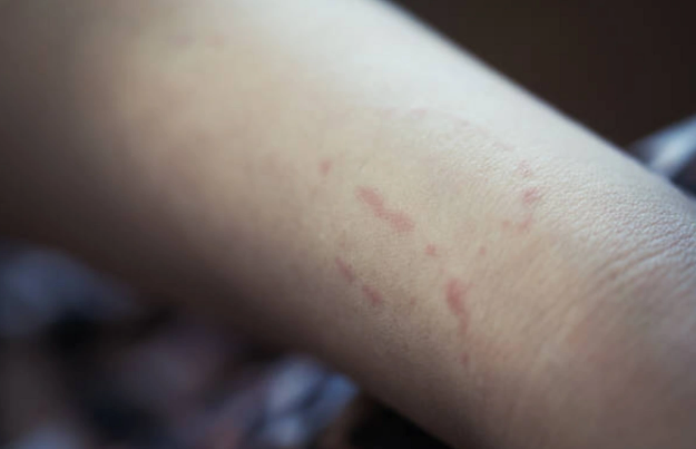 Salyanda kişi qısqanc sevgilisini döyüb dişlədi