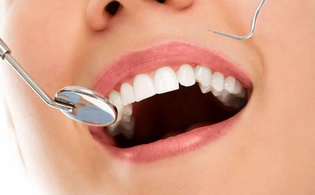 Dişlərin sayı və vəziyyəti ömür uzunluğuna təsir edir - ARAŞDIRMA