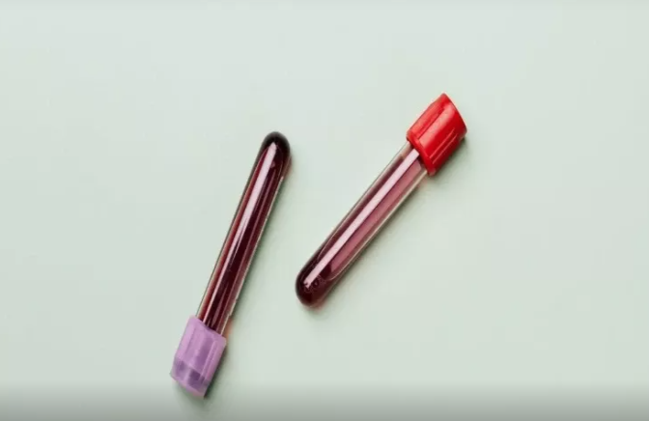 Alimlər təəccüblənirlər - Bu qan qrupundan olanlar uzunömürlü olurlar