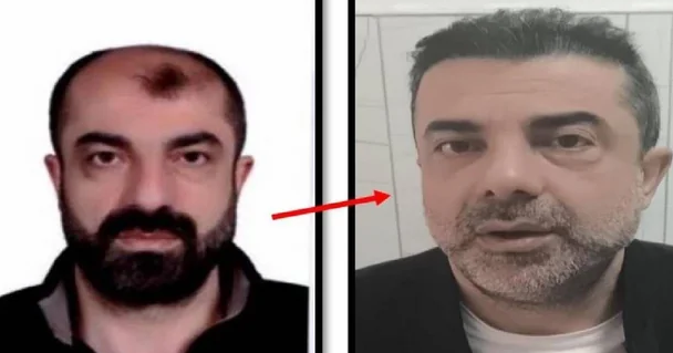 Əməliyyatla üzünü dəyişdirən şəxs illər sonra Türkiyədə həbs edildi - FOTO