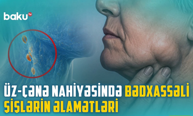 Üz-çənə travmaları və infeksiyaları necə yaranır: Çeynəmə, danışma zamanı ağrı varsa... - VİDEO