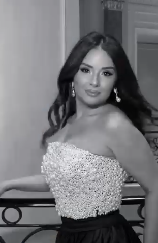 Aysel Teymurzadənin yeni görüntüsü GÖZ QAMAŞDIRDI - FOTO