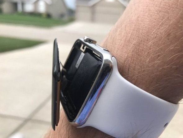 "Apple Watch" istifadəçiləri aldıqları xəsarətlərlə əlaqədar şirkəti məhkəməyə verir - FOTO