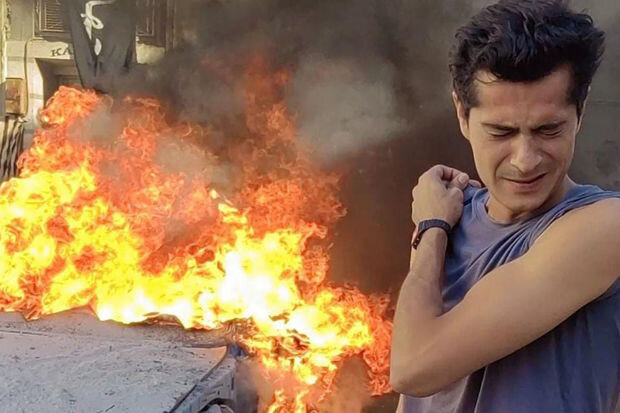 Çəkiliş zamanı partlayış oldu - İsmailin üzü yandı