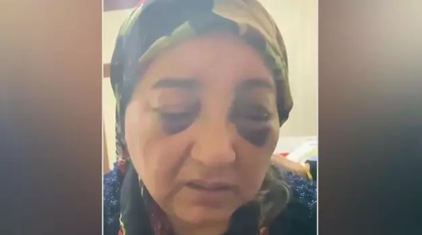 Uşaqlarının gözü önündə döyülən Aytən 2 gün ac SAXLANILDI - FOTO