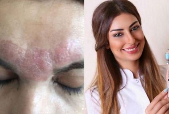 Elnarə Rzayevanın pis günə qoyduğu daha bir müştərisi (+18 VİDEO)