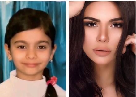 Aysun uşaqlıq fotosunu paylaşdı - hamı təəccübləndi - FOTO