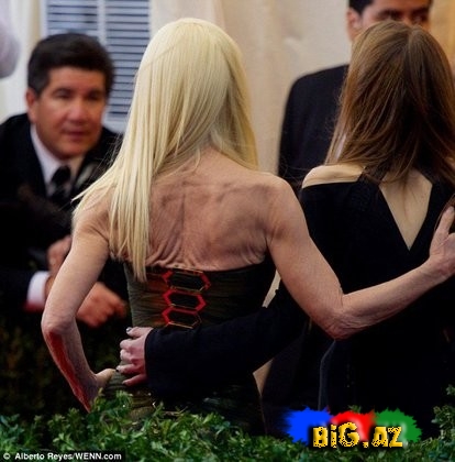 Dəb kraliçasından şok - FOTO