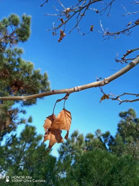 HONOR X9a və HONOR X8a smartfonlarının müqayisə icmalı