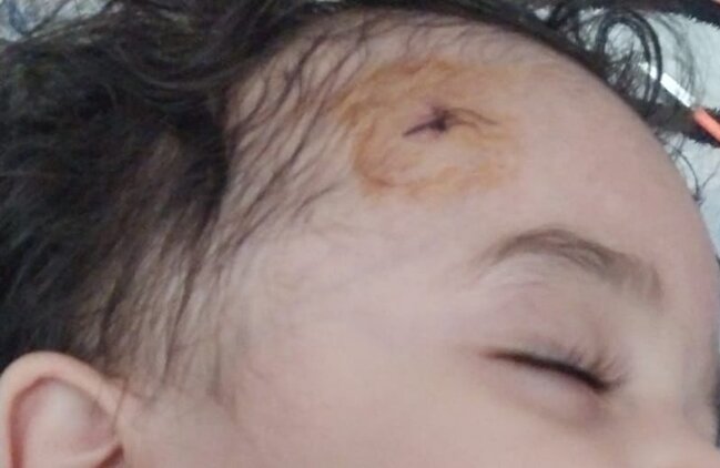 "Etimad KİDS" bağçasında uşağın başı yarıldı, ailəsinə xəbər verilmədi (FOTO)