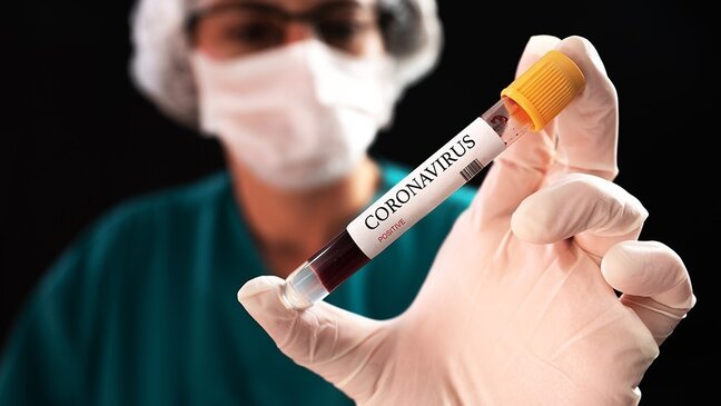 Gürcüstanda koronavirusa yoluxanların sayı 200-ü ötdü
