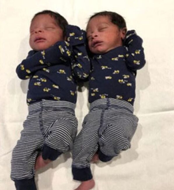 Bir ildə İKİ DƏFƏ əkiz uşaq doğdu - FOTO-VİDEO