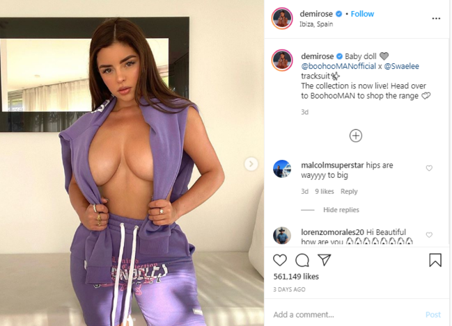 Yarıçılpaq fotosunda iri budlarına görə modeli toyuğa oxşatdılar - FOTO