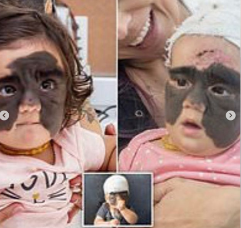 "Betman maska"lı amerikalı uşaq Rusiyada əməliyyat olunduqdan sonra - FOTO-VİDEO