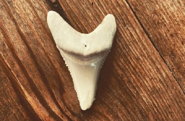 Ayağını qoparan köpəkbalığının dişinə xatir GÖRÜN NƏ ETDİ - FOTO