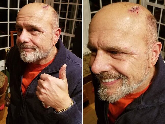 "Matrisa"nın ulduzunu xəstəxanalıq oldu - FOTO