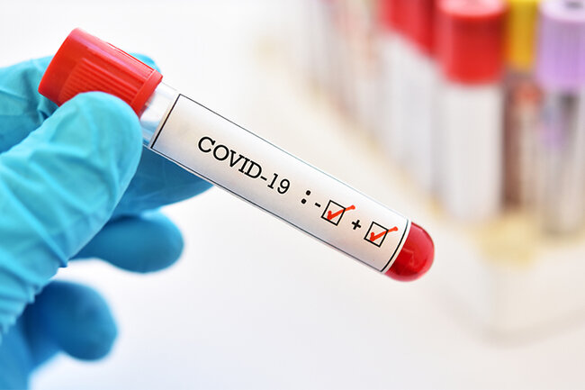 Koronavirus əlamətləri var, amma test neqativ - NƏ EDƏK?