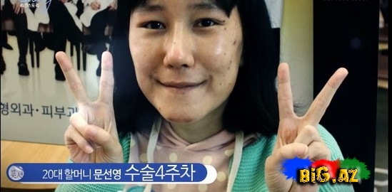 Koreyalı qadın güzgüdə özünü tanımadı - FOTO