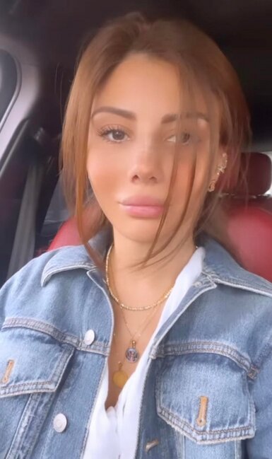 Ayselin plastik əməliyyatdan sonrakı halı - Foto