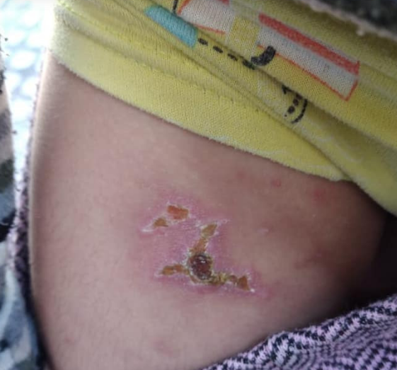 Ailəsi tərəfindən şiddət görən azyaşlı ilə bağlı YENİ XƏBƏR