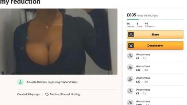 Sinəsini kiçiltmək üçün pul yığan qız ələ salındı - FOTO/VİDEO