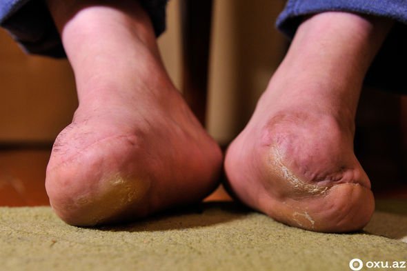 Səkkiz aylıq hamilə olan 20 yaşlı gəlini meşədə... - Xocalının izləri FOTOLARDA