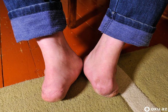 Səkkiz aylıq hamilə olan 20 yaşlı gəlini meşədə... - Xocalının izləri FOTOLARDA