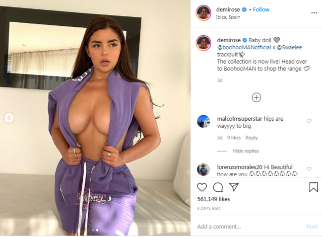 Yarıçılpaq fotosunda iri budlarına görə modeli toyuğa oxşatdılar - FOTO