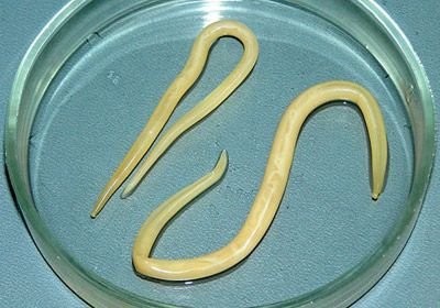 Qurd xəstəliyinin əlamətləri- qaşınma, ağız qoxusu...