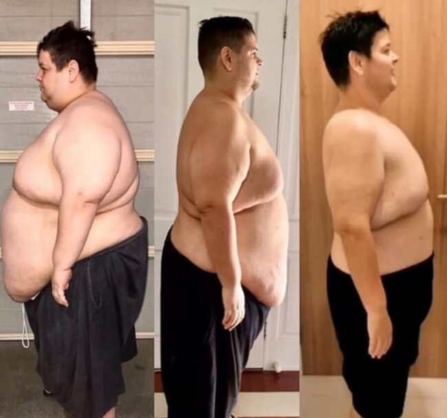 Bu adam istirahət edərək və ac qalmadan 200 kq ARIQLADI - FOTOLAR