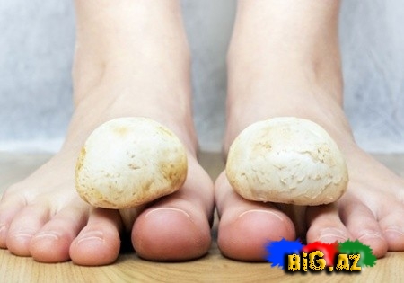 Ayaq göbələyinin müalicəsi üçün fərqli üsul