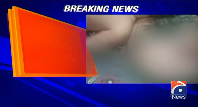 Yeni doğulan bu körpənin bir beyni İKİ BAŞI var - FOTO